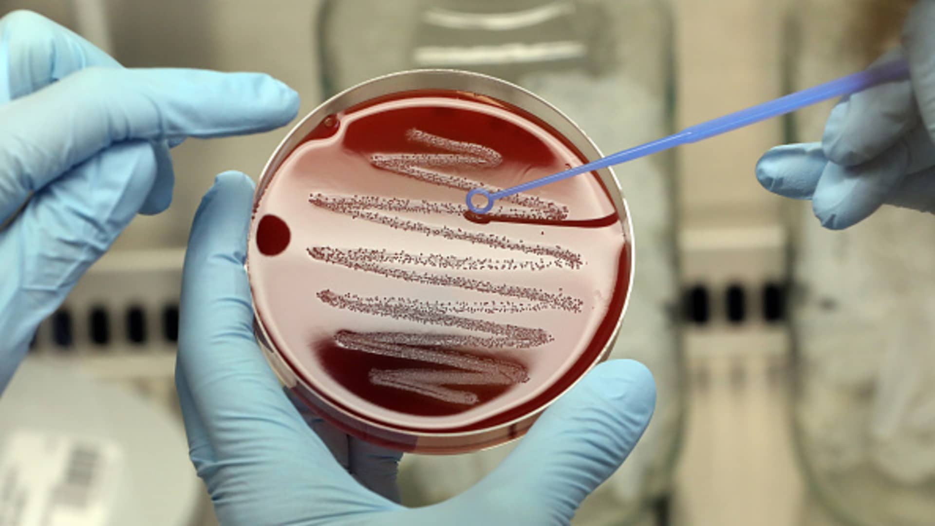 ‘The silent pandemic’: A hotter world makes it harder to stop the spread of deadly superbugs‘The silent pandemic’: A hotter world makes it harder to stop the spread of deadly superbugs