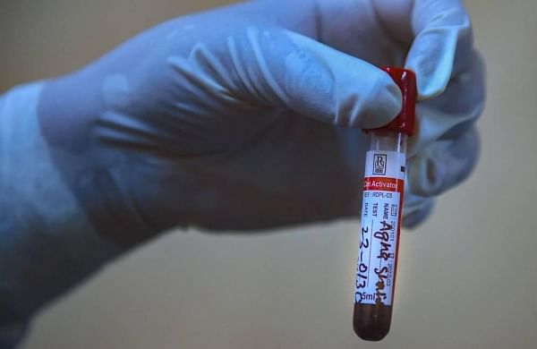 UK health service trials new ‘quick, simple’ blood test to detect cancers early